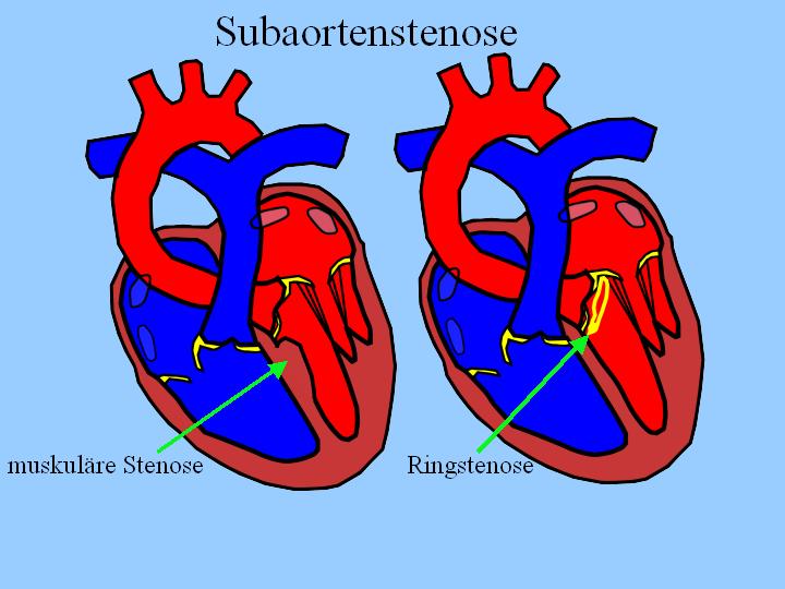 Aortenstenose (AS) Tierarztpraxis Dr. med. vet. Ingo Schneider